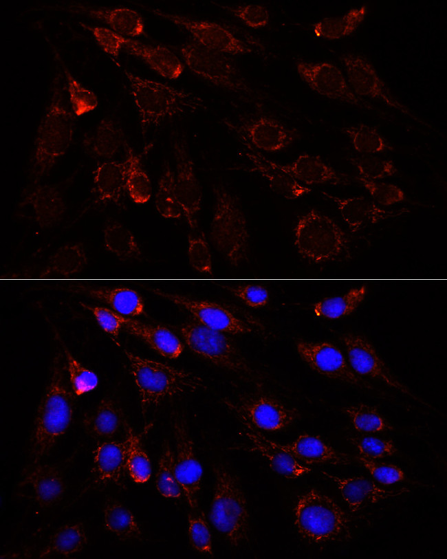 SLC25A1 Antibody in Immunocytochemistry (ICC/IF)