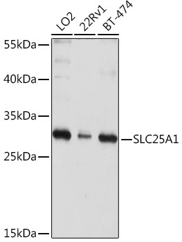 SLC25A1 Antibody in Western Blot (WB)