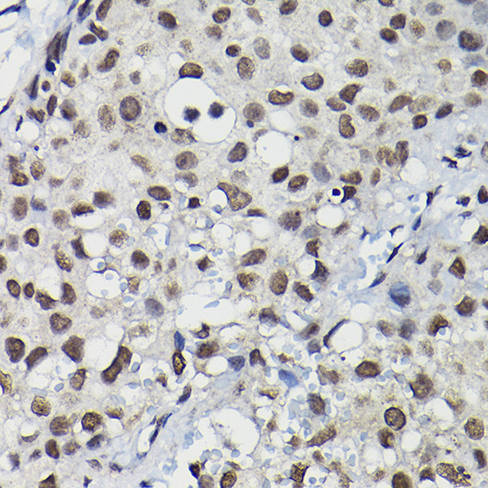 CCNK Antibody in Immunohistochemistry (Paraffin) (IHC (P))