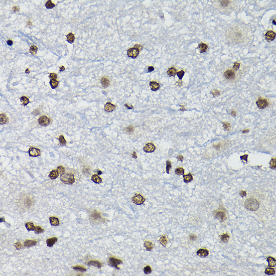 CCNK Antibody in Immunohistochemistry (Paraffin) (IHC (P))