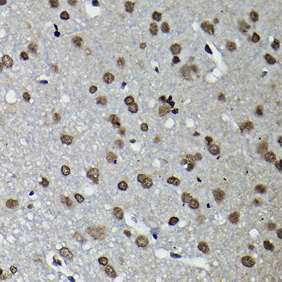 CCNK Antibody in Immunohistochemistry (Paraffin) (IHC (P))