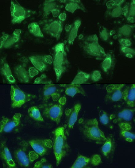 ENO1 Antibody in Immunocytochemistry (ICC/IF)