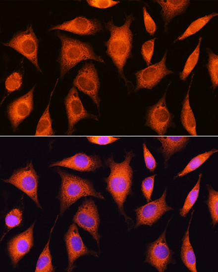 RRP4 Antibody in Immunocytochemistry (ICC/IF)