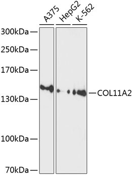 COL11A2 Antibody in Western Blot (WB)