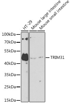 TRIM31 Antibody in Western Blot (WB)