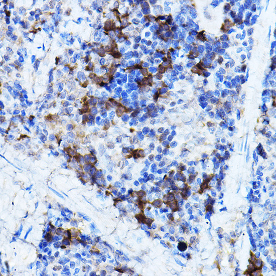 ERK2 Antibody in Immunohistochemistry (Paraffin) (IHC (P))