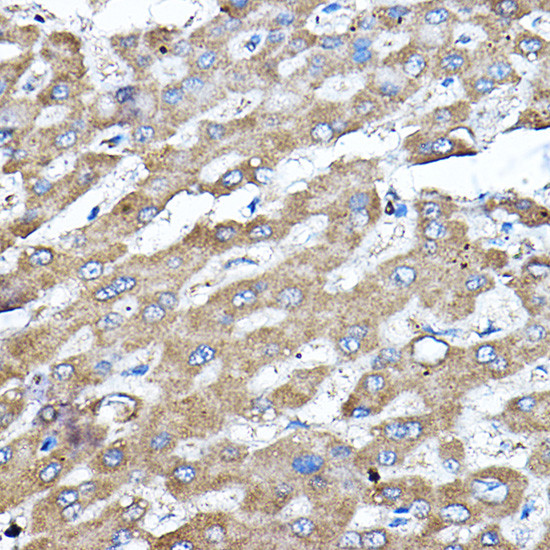 ERK2 Antibody in Immunohistochemistry (Paraffin) (IHC (P))