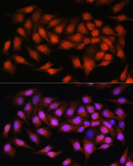 Bcl-3 Antibody in Immunocytochemistry (ICC/IF)