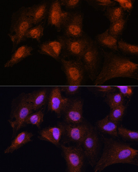 Bcl-3 Antibody in Immunocytochemistry (ICC/IF)