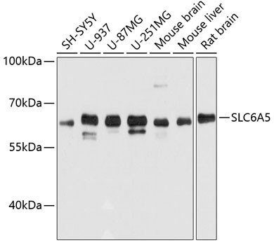 GlyT2 Antibody in Western Blot (WB)