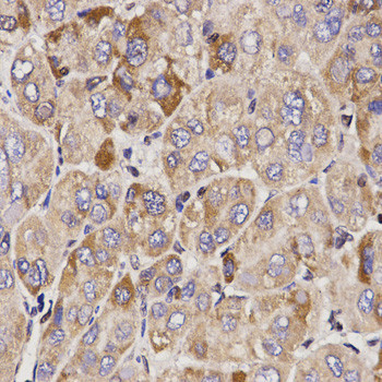 GAS2 Antibody in Immunohistochemistry (Paraffin) (IHC (P))