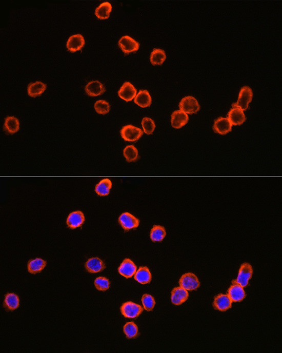 CD64 Antibody in Immunocytochemistry (ICC/IF)