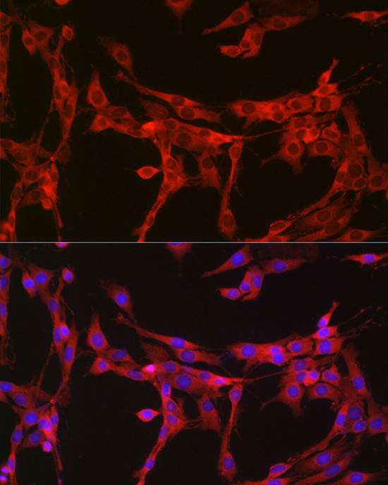 Bax Antibody in Immunocytochemistry (ICC/IF)