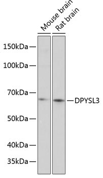 DPYSL3 Antibody in Western Blot (WB)