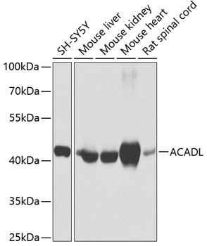 ACADL Antibody in Western Blot (WB)