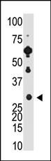 Recoverin Antibody in Western Blot (WB)