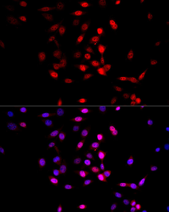 AMPK alpha-1,2 Antibody in Immunocytochemistry (ICC/IF)