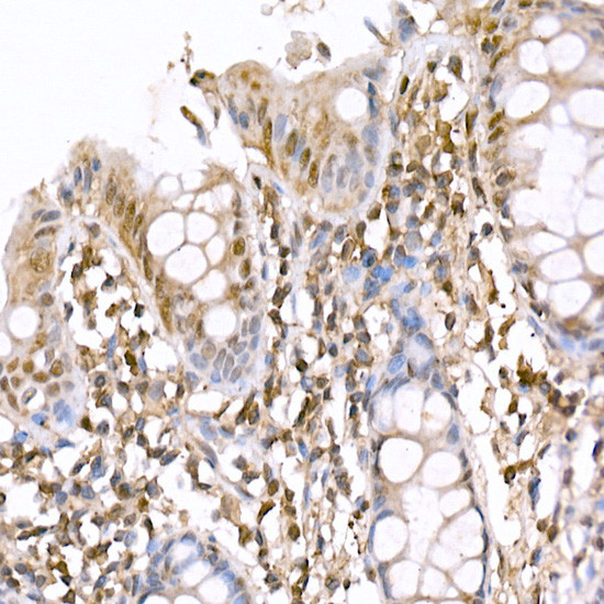 AMPK alpha-1,2 Antibody in Immunohistochemistry (Paraffin) (IHC (P))