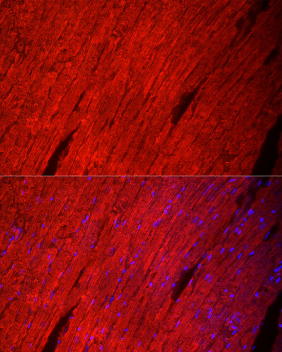 MYH6 Antibody in Immunocytochemistry (ICC/IF)