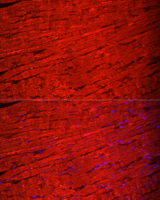 MYH6 Antibody in Immunocytochemistry (ICC/IF)