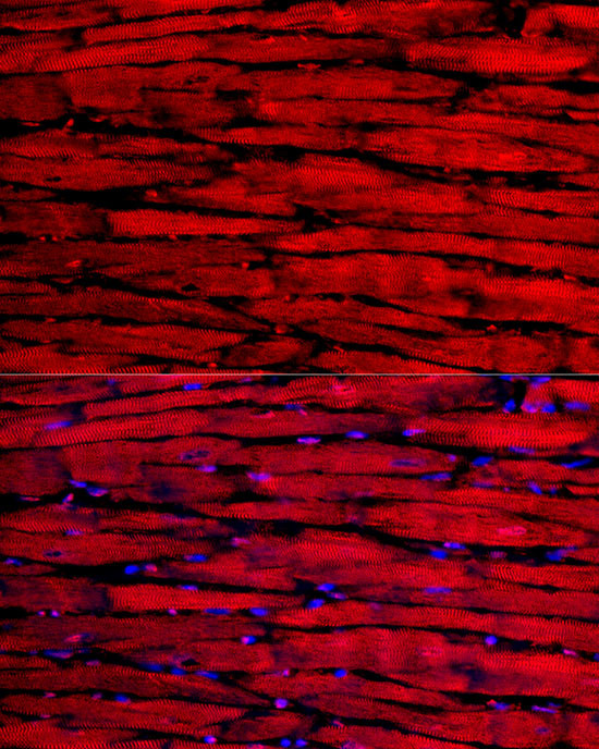 MYH6 Antibody in Immunocytochemistry (ICC/IF)