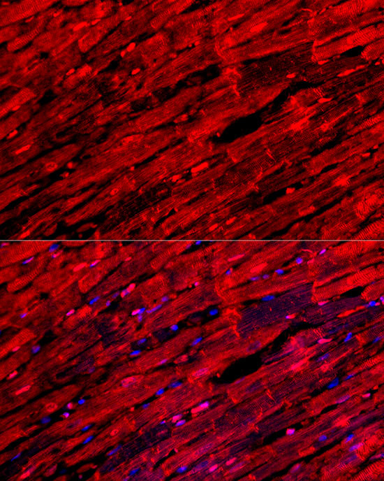 MYH6 Antibody in Immunocytochemistry (ICC/IF)