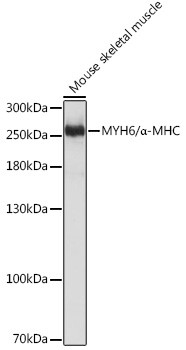 MYH6 Antibody in Western Blot (WB)