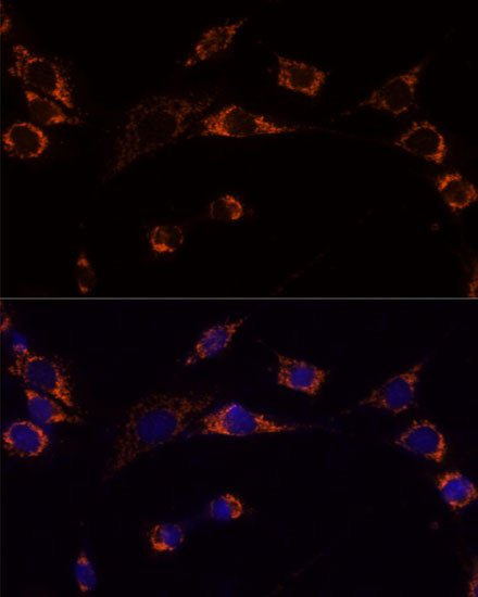 PRDX3 Antibody in Immunocytochemistry (ICC/IF)