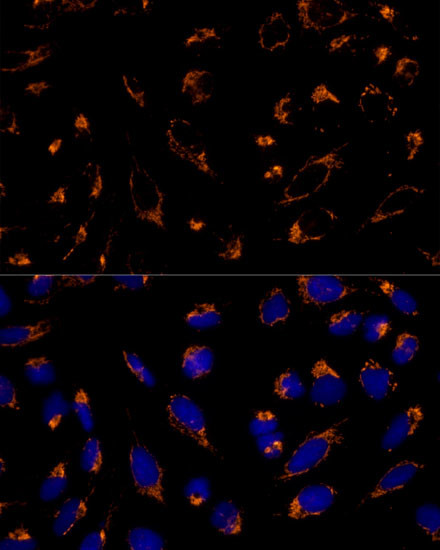 PRDX3 Antibody in Immunocytochemistry (ICC/IF)