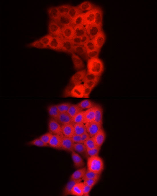 TDO2 Antibody in Immunocytochemistry (ICC/IF)