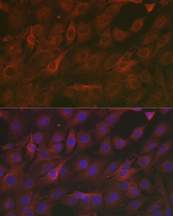 SOD2 (MnSOD) Antibody in Immunocytochemistry (ICC/IF)