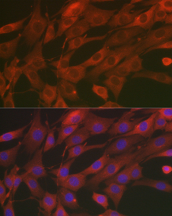 SOD2 (MnSOD) Antibody in Immunocytochemistry (ICC/IF)