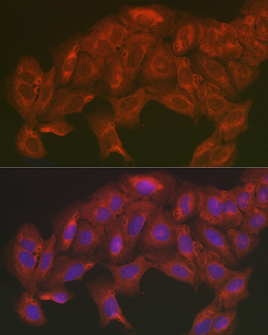 SOD2 (MnSOD) Antibody in Immunocytochemistry (ICC/IF)