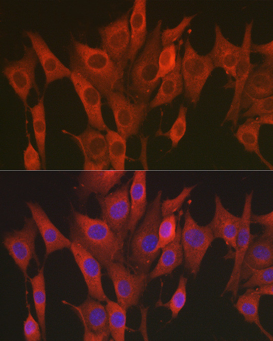 SOD2 (MnSOD) Antibody in Immunocytochemistry (ICC/IF)