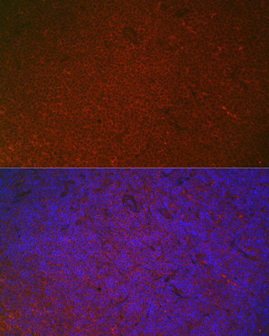 FCGR2A Antibody in Immunohistochemistry (Paraffin) (IHC (P))