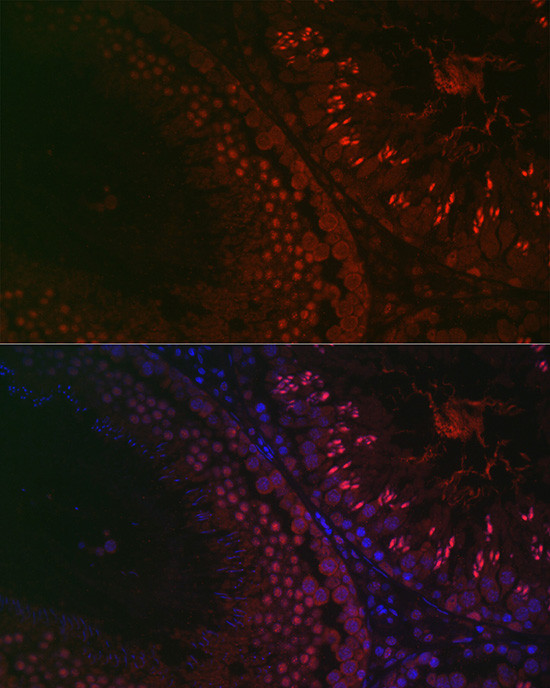 DAZL Antibody in Immunohistochemistry (Paraffin) (IHC (P))