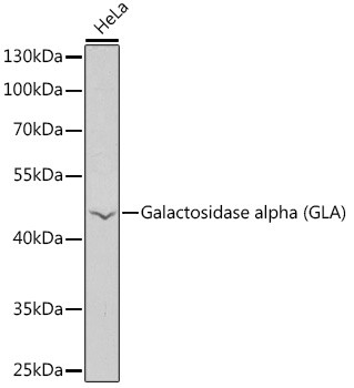 alpha Galactosidase Antibody in Western Blot (WB)