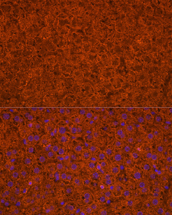 ApoC3 Antibody in Immunocytochemistry (ICC/IF)