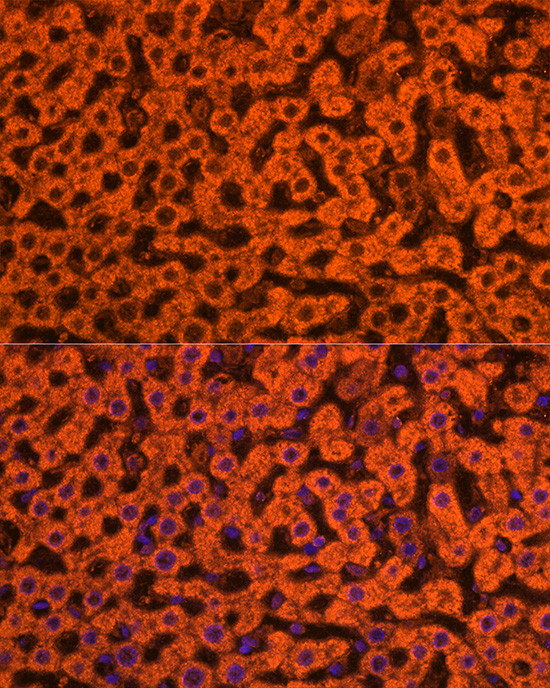 ApoC3 Antibody in Immunocytochemistry (ICC/IF)