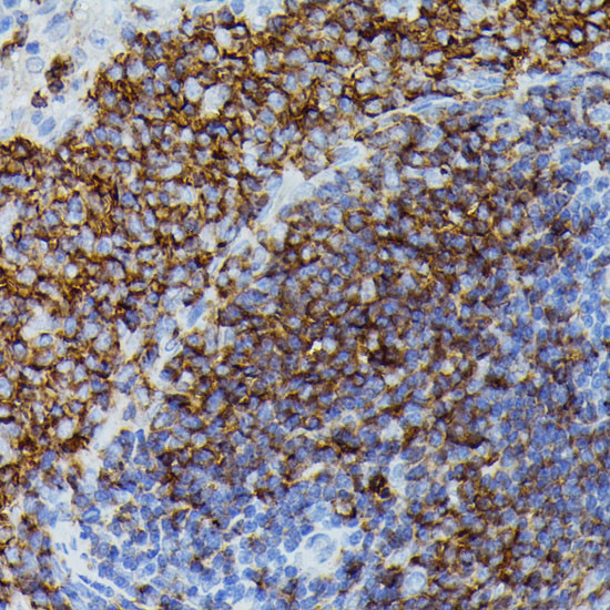 ApoC3 Antibody in Immunohistochemistry (Paraffin) (IHC (P))