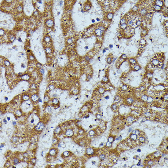 ApoC3 Antibody in Immunohistochemistry (Paraffin) (IHC (P))