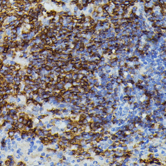 ApoC3 Antibody in Immunohistochemistry (Paraffin) (IHC (P))