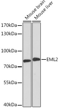 EML2 Antibody in Western Blot (WB)