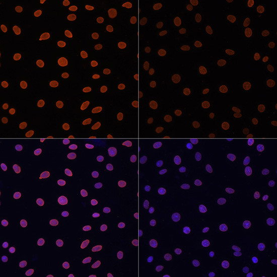 H4K12ac Antibody in Immunocytochemistry (ICC/IF)