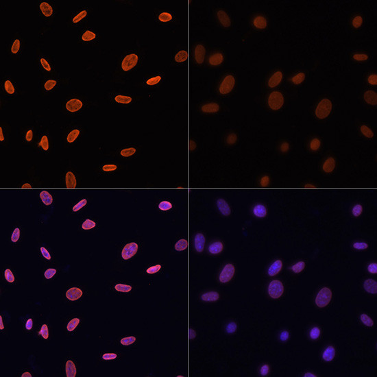 H4K12ac Antibody in Immunocytochemistry (ICC/IF)