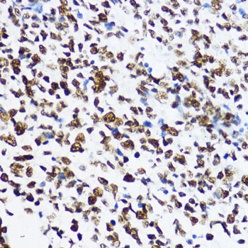 H4K12ac Antibody in Immunohistochemistry (Paraffin) (IHC (P))