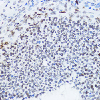 H4K12ac Antibody in Immunohistochemistry (Paraffin) (IHC (P))