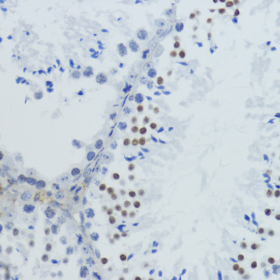 H4K12ac Antibody in Immunohistochemistry (Paraffin) (IHC (P))