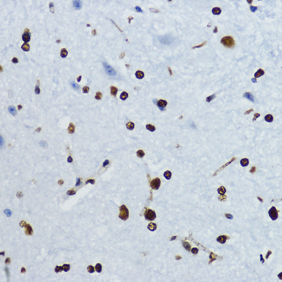 H4K12ac Antibody in Immunohistochemistry (Paraffin) (IHC (P))