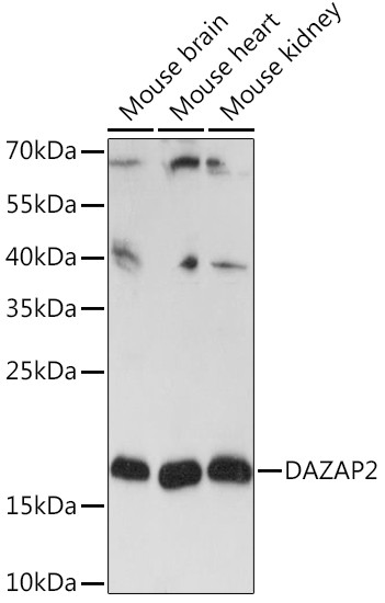 DAZAP2 Antibody in Western Blot (WB)